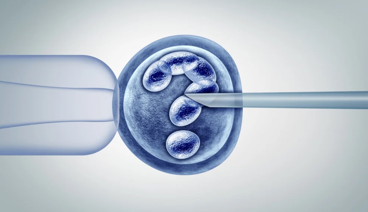 Ultimate Guide to Understanding IVF Step-By-Step