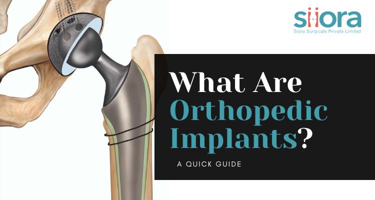 What Are Orthopedic Implants? A Quick Guide