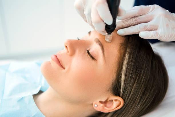 Microneedling Cost Toronto: Factors, Pricing, and Considerations