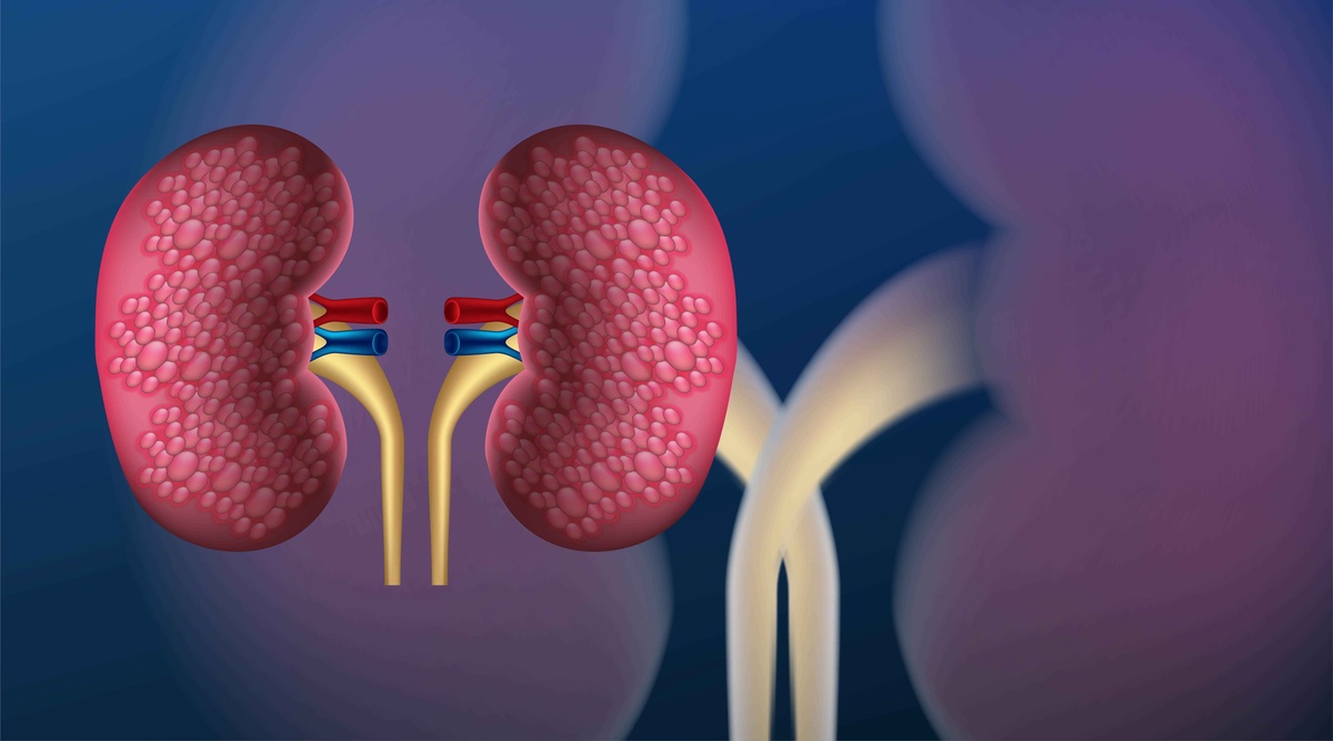 Understanding ICD 10 Codes for Urinary Tract Infections (UTI)