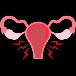 Understanding Endometriosis: Seeking Treatment from a Gynecologist in Patna