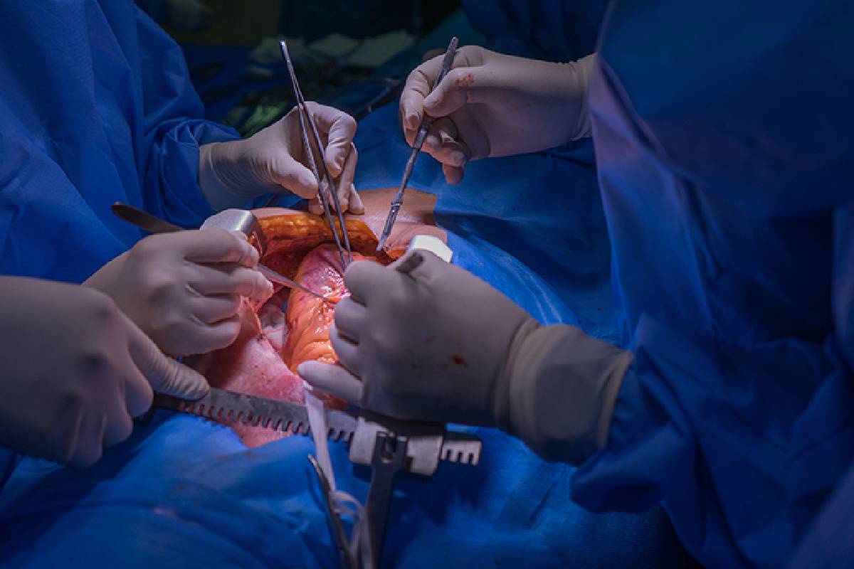 Understanding the Life-Saving Benefits and Techniques of Open-Heart Surgery