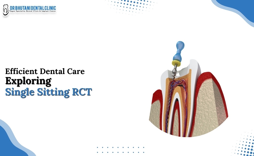 Efficient Dental Care Exploring Single Sitting RCT