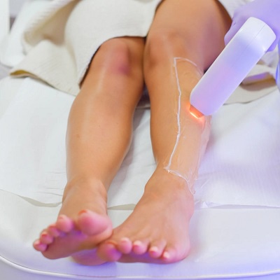Unveiling the Magic of Laser Hair Removal: A Comprehensive Guide