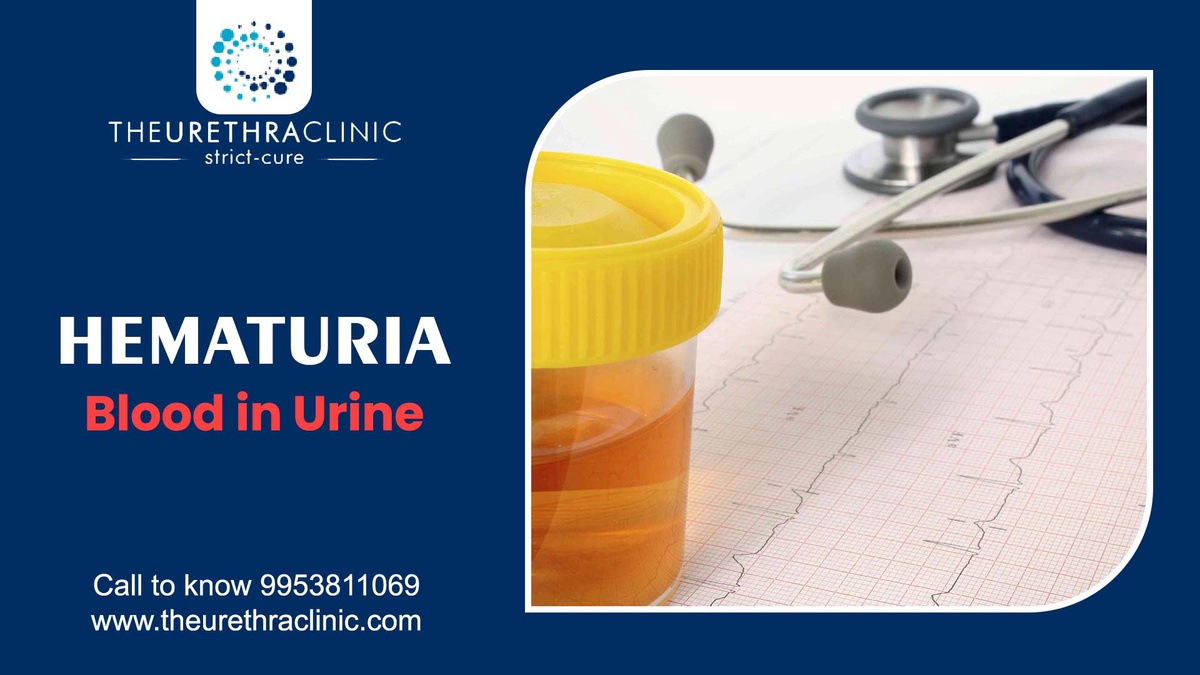 What is the most common cause of blood in urine