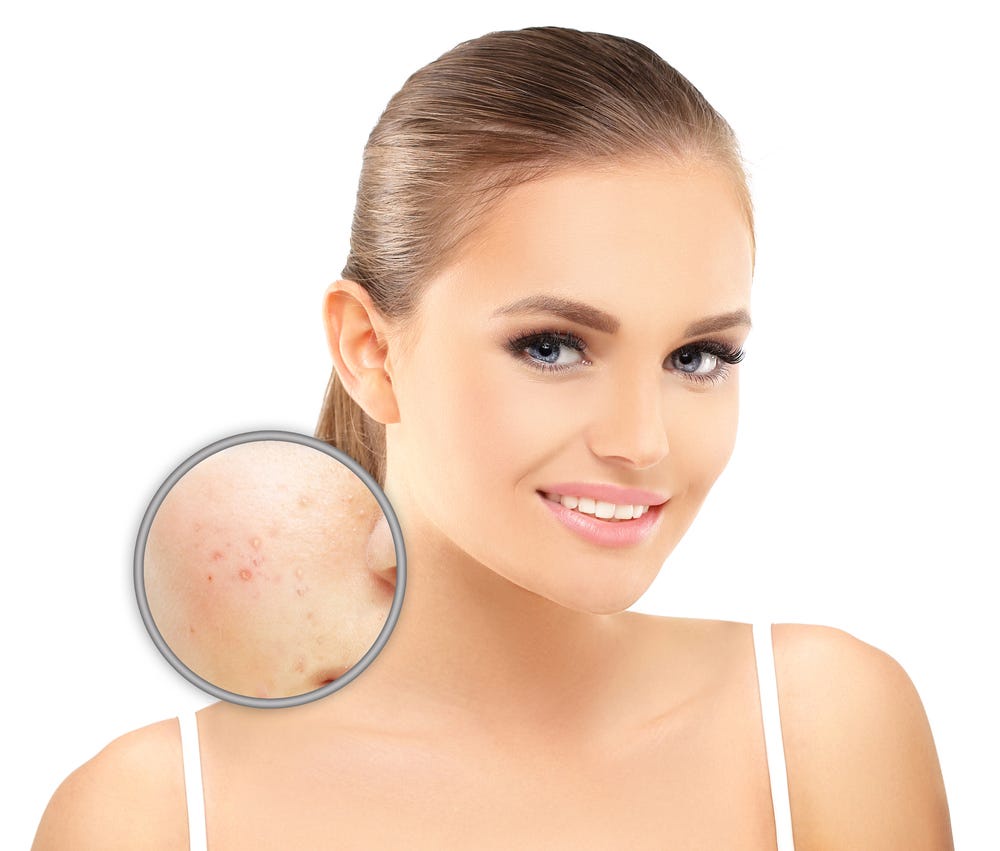 5 Must-Know Tips for Effective Pigmentation Treatment in Dubai