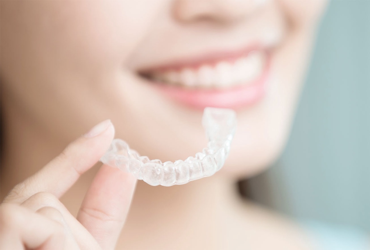 The Ultimate Guide to Finding the Best Invisalign Treatment for You