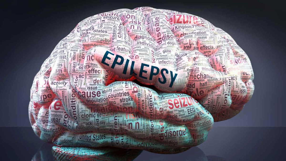 Understanding the Psychological Impact of Epilepsy and Emotions
