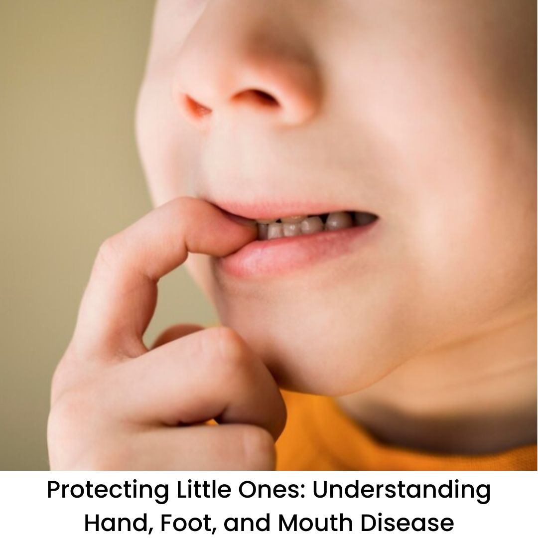 Protecting Little Ones: Understanding Hand, Foot, and Mouth
