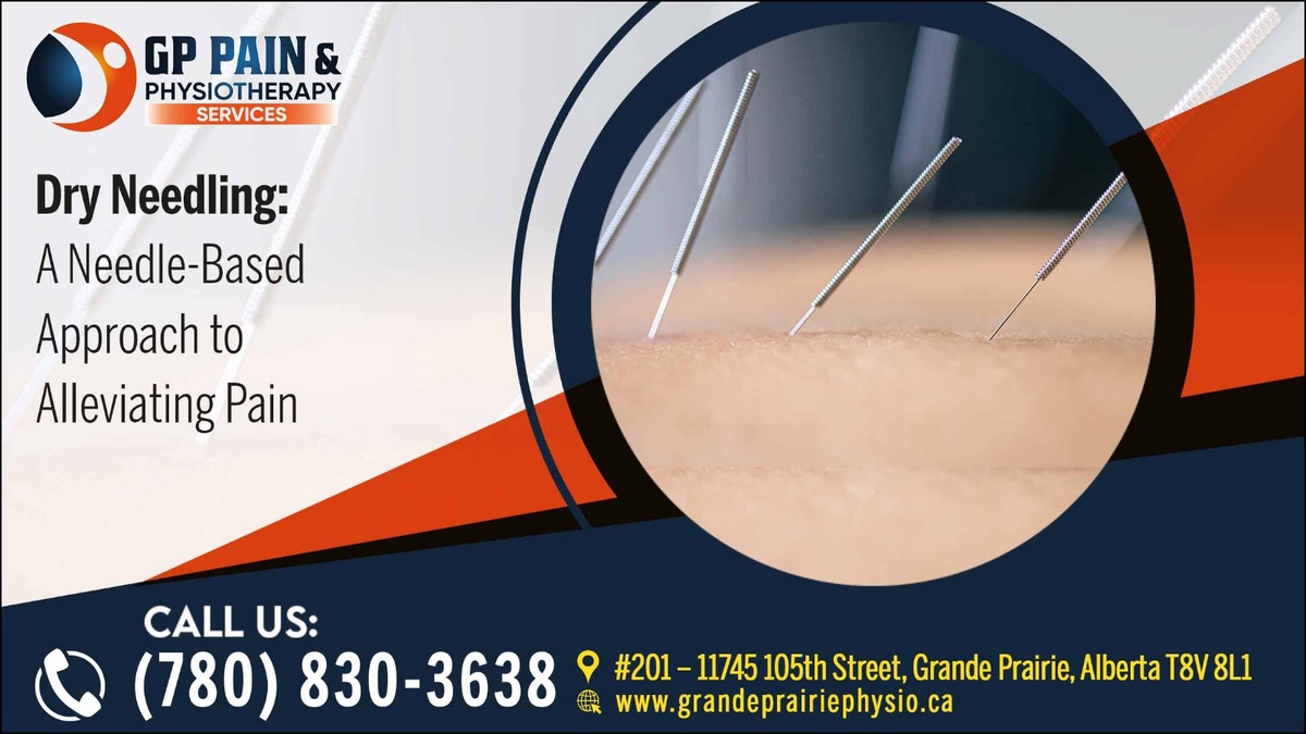 Dry Needling Therapy Grande Prairie at G.P. Pain & Physiotherapy