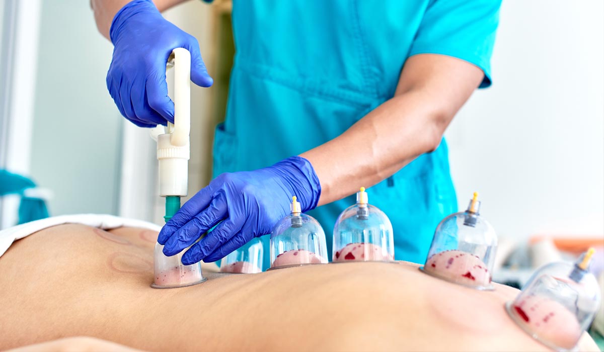 Empower Your Body: Hijama Treatment for Optimal Health