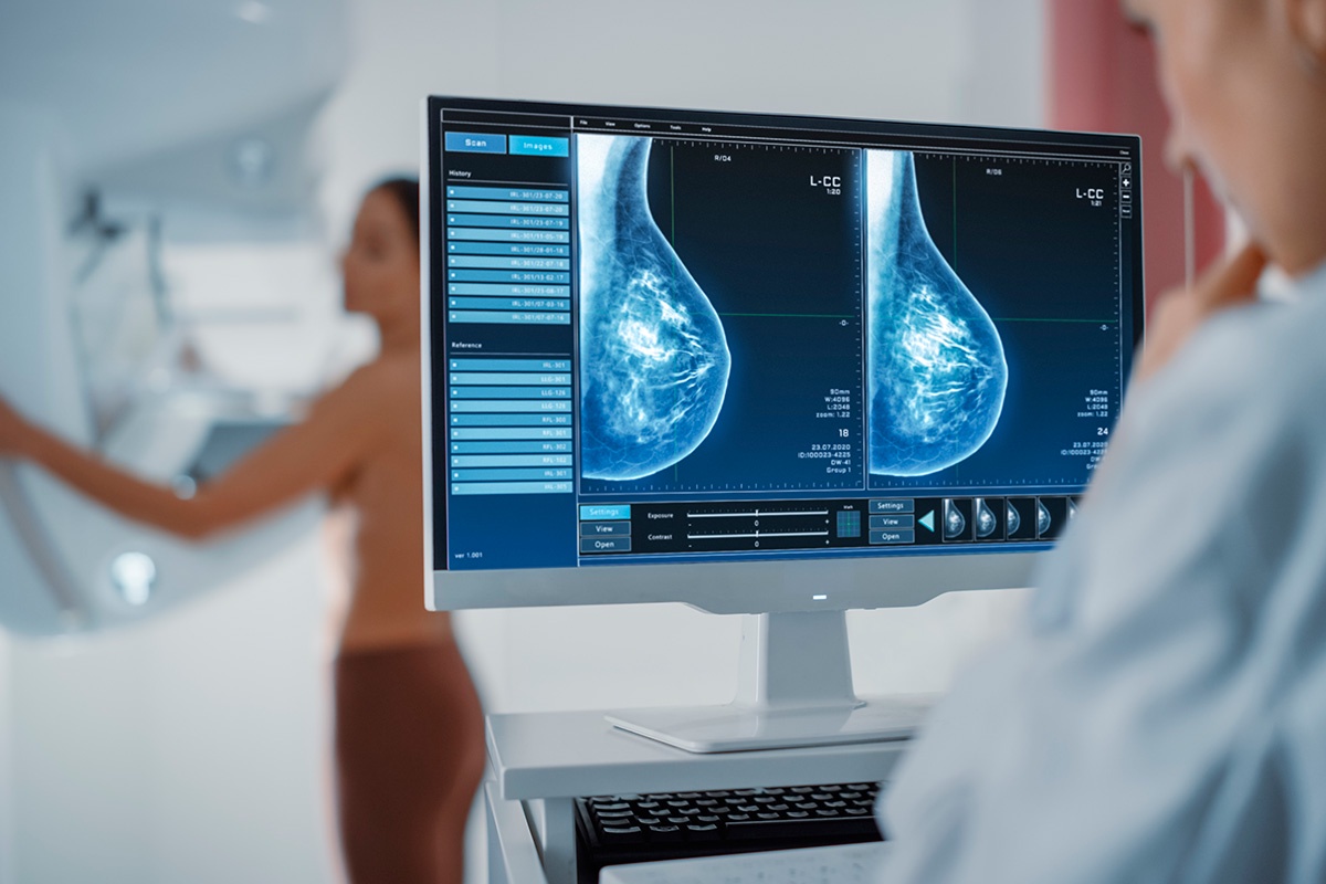 Artificial intelligence revealed signs of cancer in women - doctors did not find them