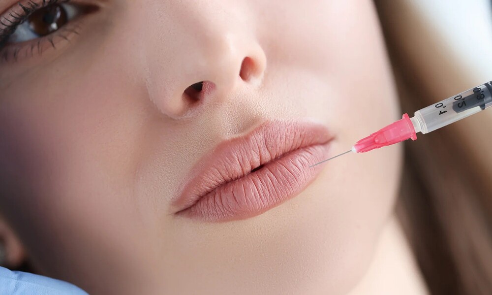 The Best Lip Fillers in Calgary