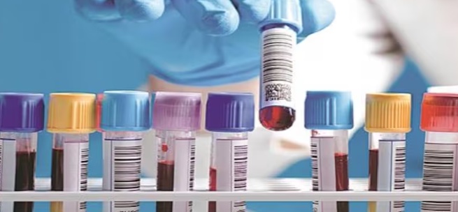 What does a creatine kinase blood test measure?