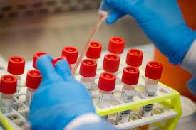 Why is PCR testing required for traveling?