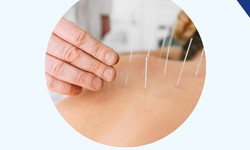 What are the benefits and risks of acupuncture therapy?