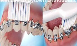 Dental Insurance Can Help You With Efficient Oral Treatment