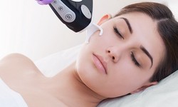 5 things to know about fractional laser treatments