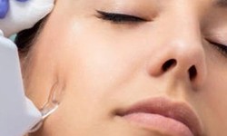 Understanding Mesotherapy Facial Skin Treatment
