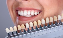 Teeth Whitening for Sensitive Teeth: The Ultimate Guide