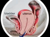 Top Benefits Of Robotic Gynecology