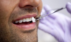 Get The Perfect Smile With Porcelain Veneers From A Dentist Open On Saturdays!