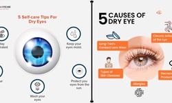 What Are The Causes Of Dry Eye Disease And Its Possible Treatment?