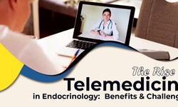 The Rise Of Telemedicine In Endocrinology: Benefits & Challenges