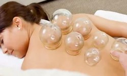 What Is Cupping And How Does Cupping Therapy Work?