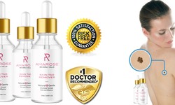 Amarose Skin Tag Remover Reviews (2022 UPDATED) Amarose Serum Really Works?