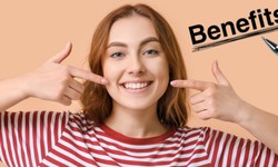 Amazing Benefits of Smile Makeover