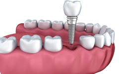 What is the importance of the scope of top-quality dentistry nowadays?