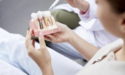 Advantage of Oral Surgery in Tustin
