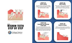 Find out Why You Need to Remove Your Wisdom Teeth