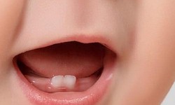 Tips For Taking Care Of Baby Teeth