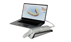 How to Choose Your Next Intraoral Scanner
