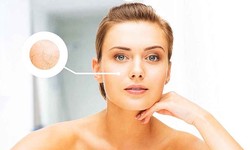 Improve Facial Flaccidity with These Treatments