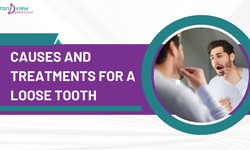 Causes and treatments for a loose tooth
