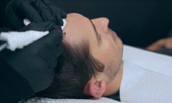 Aftercare Tips for Scalp Micropigmentation