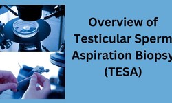 An Overview of Testicular Sperm Aspiration Biopsy with IVF treatment in Rwanda