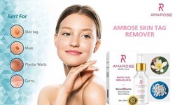 Amarose Skin Tag Remover Reviews Where To Buy Today!! Special Offer