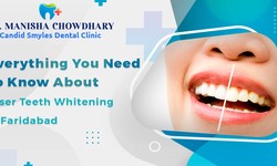 Everything You Need to Know about Laser Teeth Whitening in Faridabad