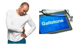 Is Gallstone Dangerous and How to Treat This Condition?
