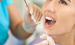 The Art of Tooth Restoration: Exploring Cavity Filling Techniques