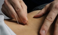 Dry Needling Therapy, Blood Flow Restriction, & Cupping: Does It Work for Athletes?