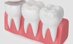 Improve Your Cracked Tooth Through Dental Crown Services