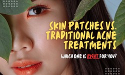 Skin Patches vs. Traditional Acne Treatments: Which One is Right for You?