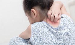 Common Skin Problems In Children