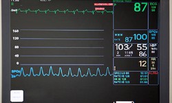 The main points of Patient Monitor operation that you must master