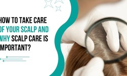 HOW TO TAKE CARE OF YOUR SCALP AND WHY SCALP CARE IS IMPORTANT?